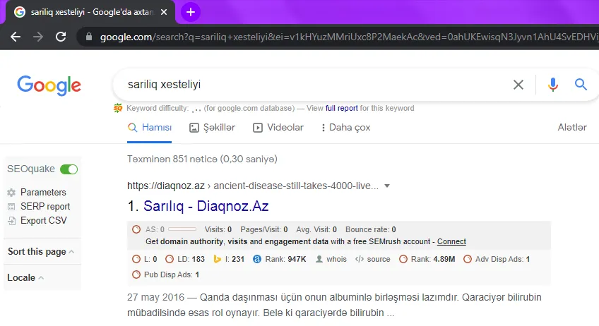 Diaqnoz.az — «sarılıq xəstəliyi» sorğusunda Google-da 1-ci yer