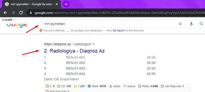 Diaqnoz.az — «mrt qiymətləri» sorğusunda Google-da 2-ci yer
