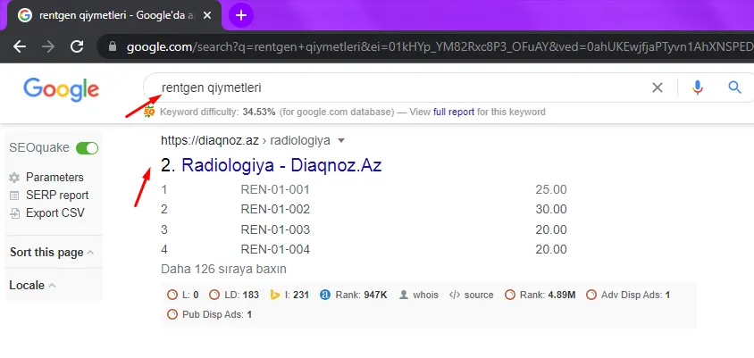 Diaqnoz.az — «rentgen qiymətləri» sorğusunda Google-da 2-ci yer