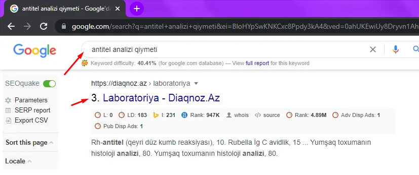 Diaqnoz.az — «antitel analizi qiyməti» sorğusunda Google-da 3-cü yer
