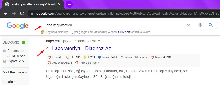 Diaqnoz.az — «analiz qiymətləri» sorğusunda Google-da 4-cü yer