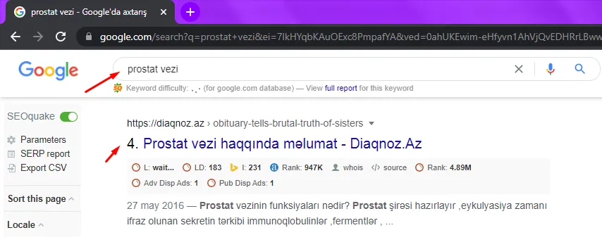 Diaqnoz.az — «prostat vəzi» sorğusunda Google-da 4-cü yer