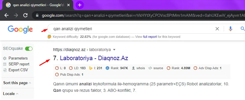 Diaqnoz.az — «qan analizi qiymətləri» sorğusunda Google-da 7-ci yer